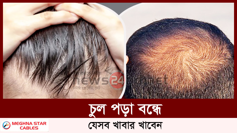 চুল পড়া বন্ধে যেসব খাবার খাবেন