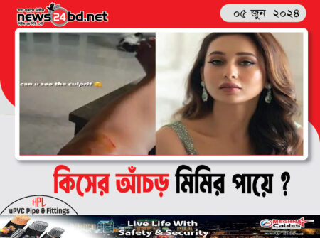 কিসের আঁচড় মিমির পায়ে