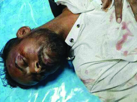 হিরো আলমকে মেরে গুরুতর আহত, ভর্তি হাসপাতালে