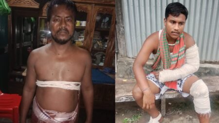 সোনারগাঁওয়ে বাবা ছেলেকে কুপিয়ে জখম